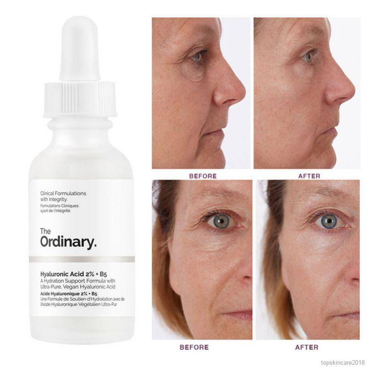 سرم هیالورونیک اسید اوردینری Ordinary