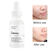 سرم هیالورونیک اسید اوردینری Ordinary