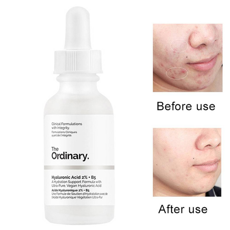 سرم هیالورونیک اسید اوردینری Ordinary